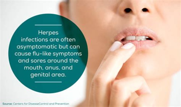 Can You Use Boric Acid If You Have Herpes