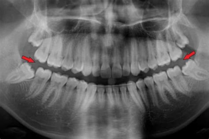 Definitions of crot - OneLook
