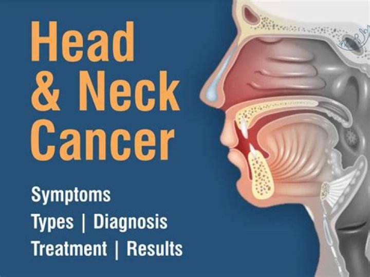 Head and Neck Cancer