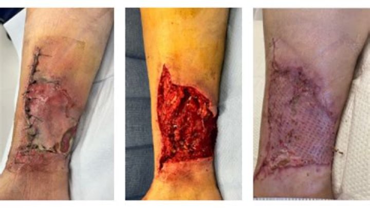 KU Department of Plastic, Burn and Wound Surgery