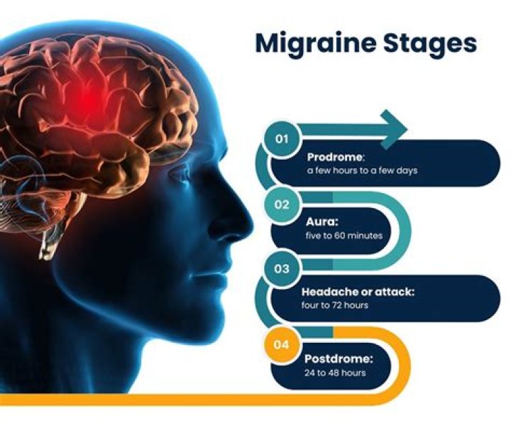 Neurologists Explain Why Weather Is a Migraine Trigger